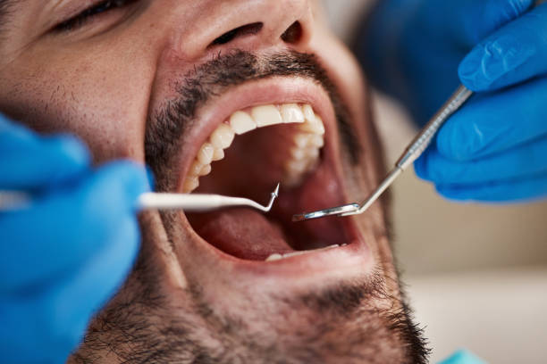 Best Chipped Tooth Repair Near Me  in Homedale, ID